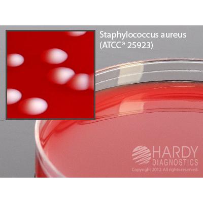 Columbia Blood Agar, 5% sheep, 15x100mm plate, Hardy Diagnostics